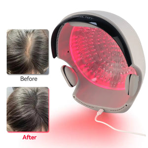 VolumeMax Hair Growth Helmet 162 Laser Diodes - FDA Cleared