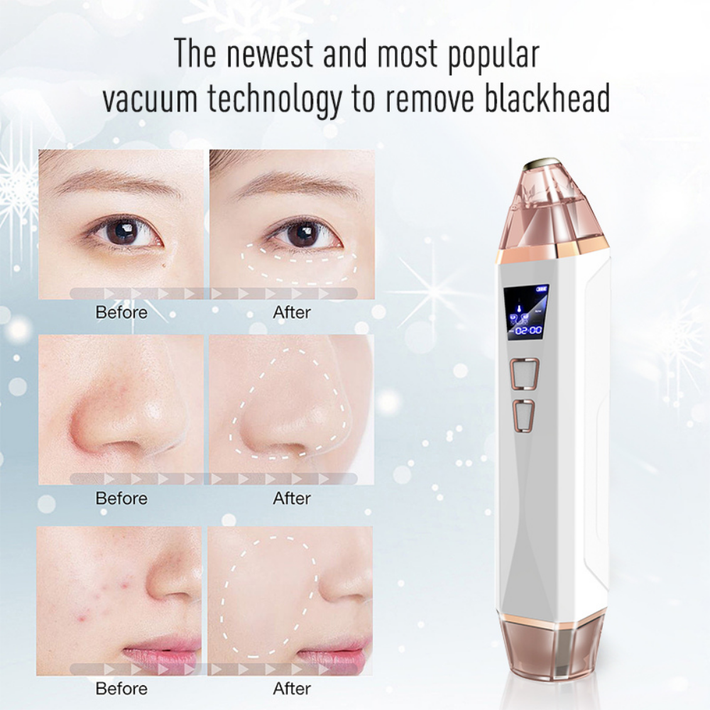 Femvy Blackhead Remover 2.0 white version with 3 rows of before and after images