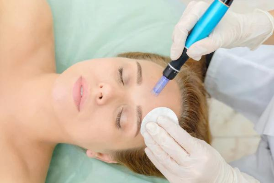 What To Put On Skin After Microneedling