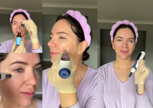 A women showcasing how to use Dr Pen A11 to perform microneedling