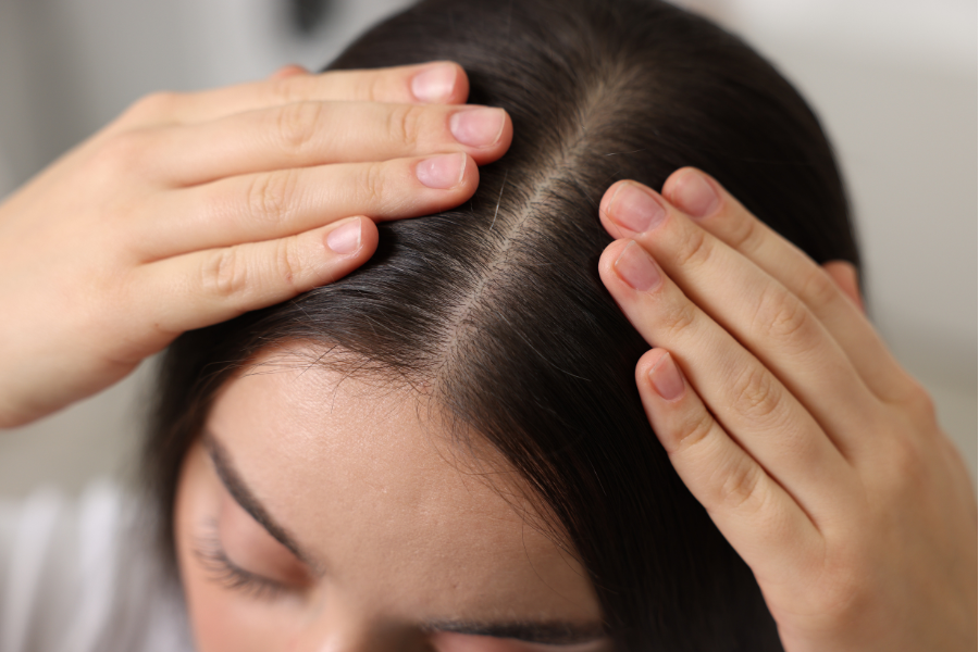 The Role of Scalp Health in Hair Regrowth