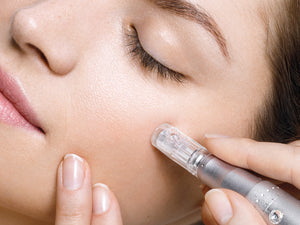 Who can get microneedling?