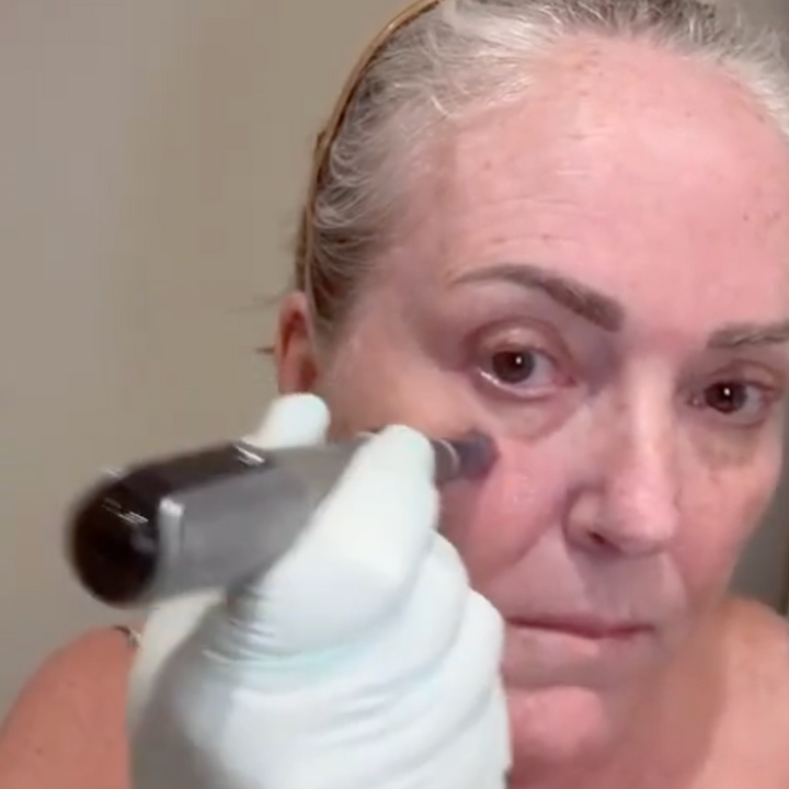 *NEW* Dr. Pen M8S Microneedling Pen