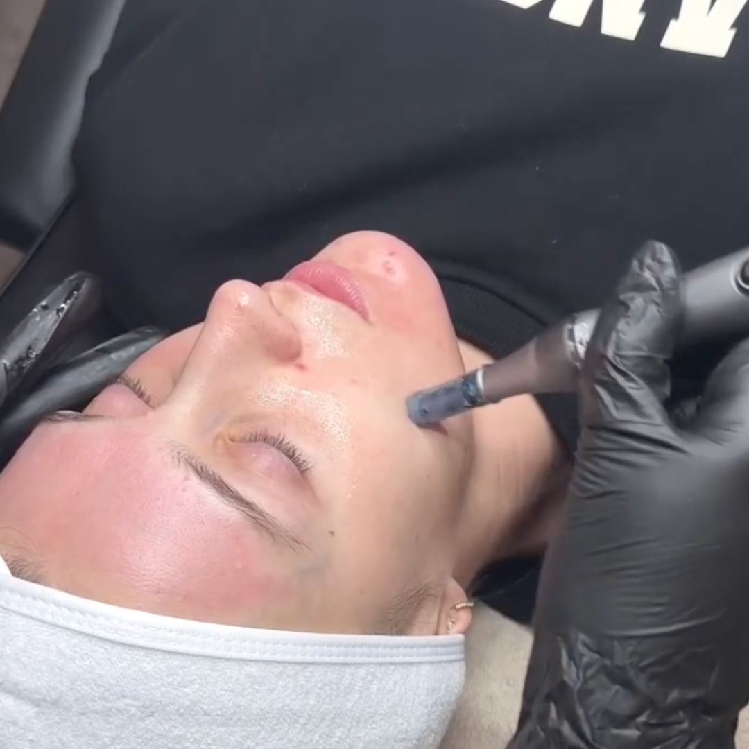*NEW* Dr. Pen M8S Microneedling Pen