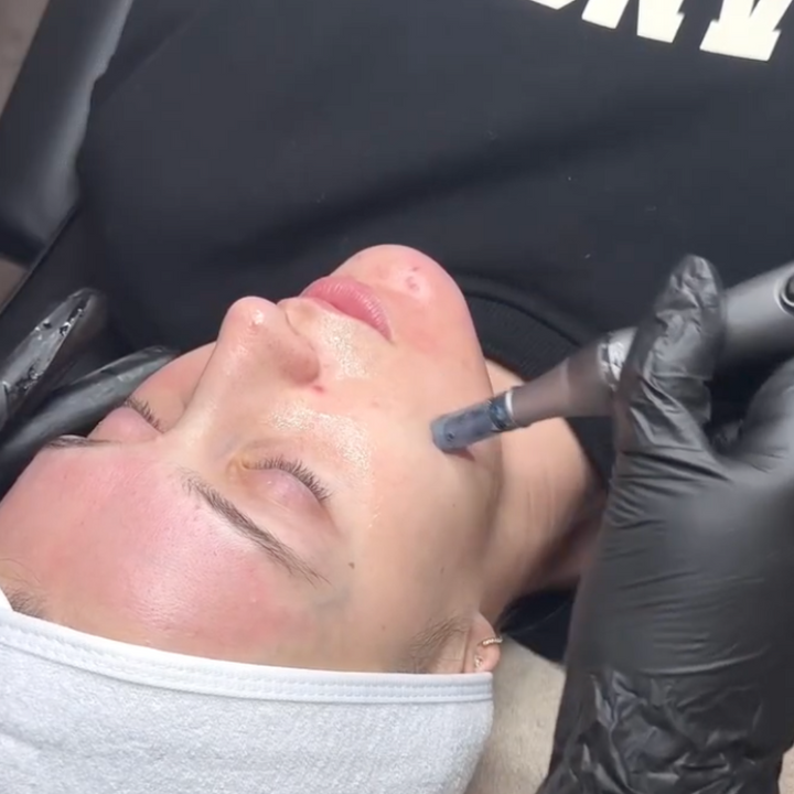 *NEW* Dr. Pen M8S Microneedling Pen