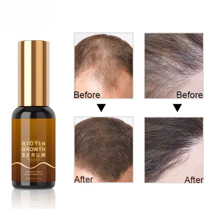 Biotin Hair Growth Serum 30ml