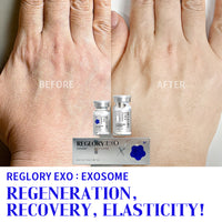 Reglory EXO Exosome Skin Booster
