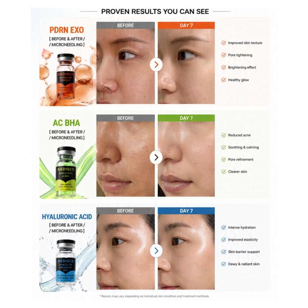 Medisco Skinbooster before and after results for PDRN Exo, AC BHA and Hyaluronic Acid after microneedling