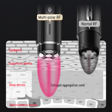 Load image into Gallery viewer, PRO Facial RF Skin Tightening Wand multipular illustration