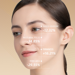 PRO Facial RF Skin Tightening Wand benefits
