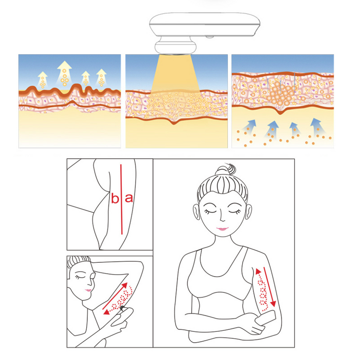 Peachaboo Face and Body Skin Tightening Radio Frequency Device With Aloe Vera Gel