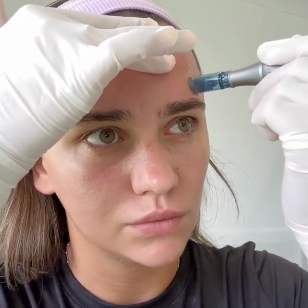 *NEW* Dr. Pen M8S Microneedling Pen