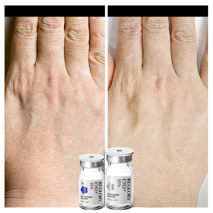 Before and after comparison of skin texture.