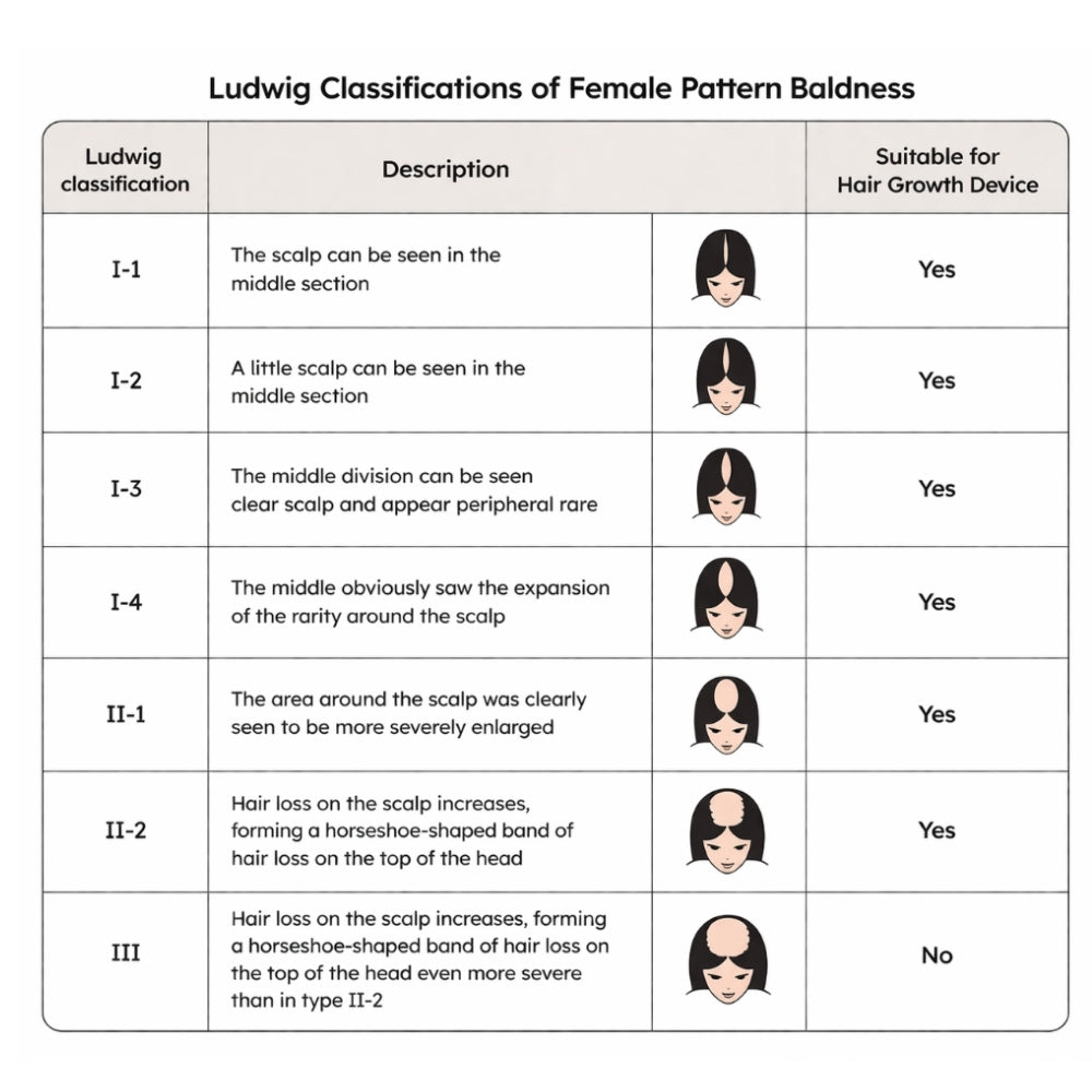 Table of Ludwig classifications for female pattern baldness with corresponding images and suitability for Reboot Volume Max Hair Growth Helmet 