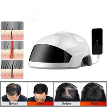 Load image into Gallery viewer, VolumePro Hair Growth Helmet 46 Laser Diodes 60 LED