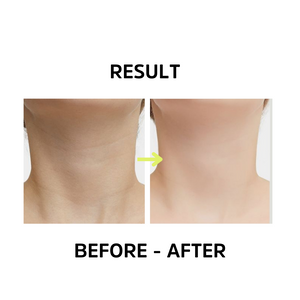 image of a woman's neck after and before using femvy 3 in 1 neck sculpting tool